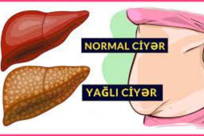 <p>20 qəpiklik məhsulla qaraciyər yağlanmasını AZALDIN</p>